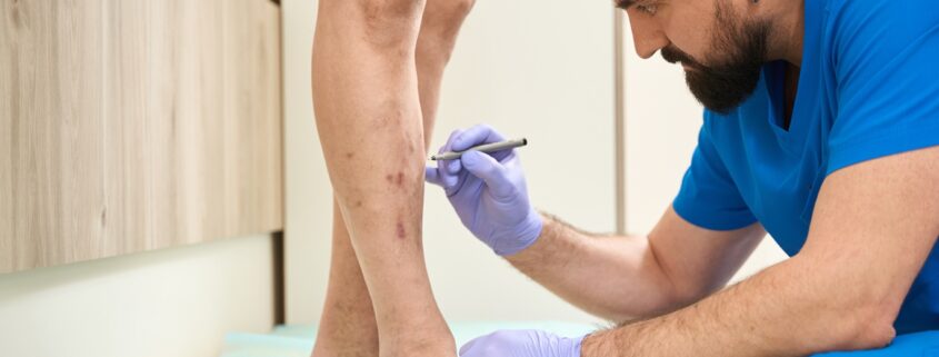 Simple Lifestyle Changes to Prevent and Manage Vein Disorders