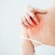 How to Track Your Skin Symptoms for Better Doctor Visits