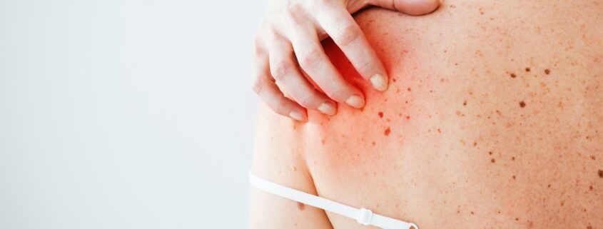 How to Track Your Skin Symptoms for Better Doctor Visits